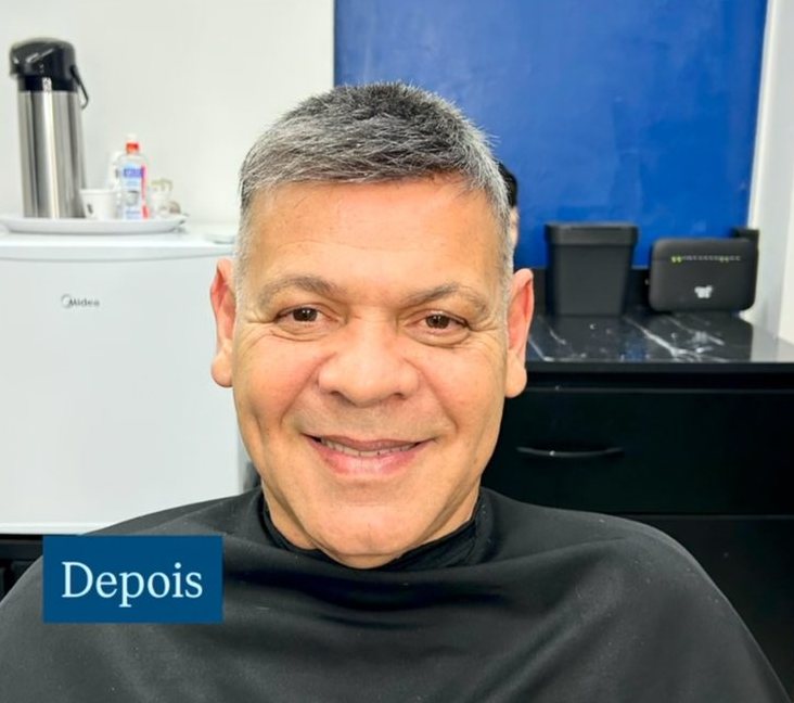 Mesmo cliente depois da prótese capilar