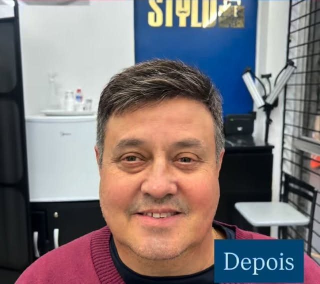 Mesmo cliente depois da prótese capilar